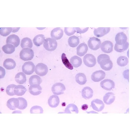 Scientific Device Lab - Naegleria Fowleri - 8970 - Parasitology Stained ...