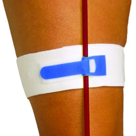 Pepper Medical - Foley-Tie - 606 - Catheter Holder Foley-Tie Velcro  Blue
