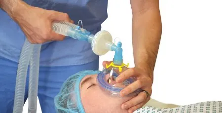 Flexicare - Ventiflow - 038-01-715U - Ventiflow Anesthesia Breathing Circuit Expandable Tube 72 Inch Tube Single Limb Adult 3 Liter Bag Single Patient Use