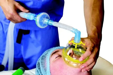 Flexicare - 038-02-683U - Flexicare Anesthesia Breathing Circuit Corrugated Tube 60 Inch Tube Dual Limb Pediatric 1 Liter Bag Single Patient Use Jackson-rees Circuit