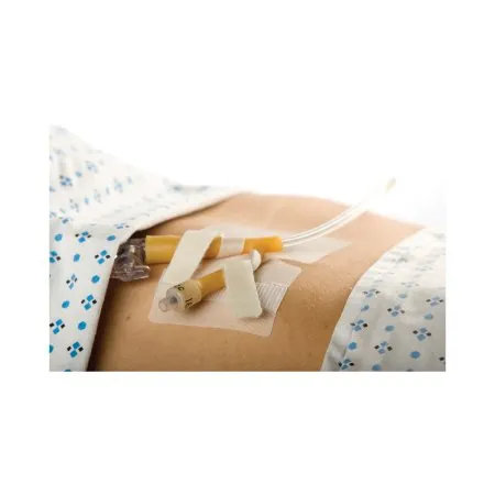 M.C. Johnson - Cath-Secure Dual Tab - 5445-4 - Cath Secure Dual Tab Catheter Holder Cath Secure Dual Tab 3 Inch Wrap Tabs x 3 Inch Wide Base