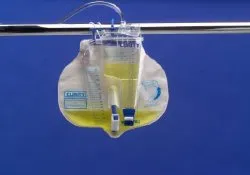 Dover - Medtronic / Covidien - 2006 - 400mL Urine Meter Foley Tray, 16FR, 5cc Silicone Foley Catheter, 10/cs