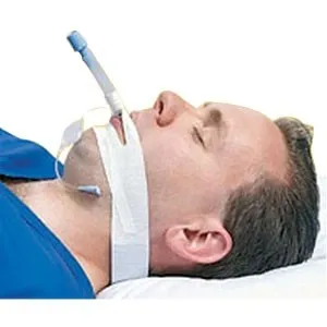 Nurse Assist - Other Brands - 2700 - Trach Tape Endotracheal Tube Securing Device, 100/bx
